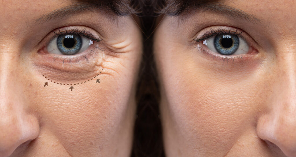 eye-care