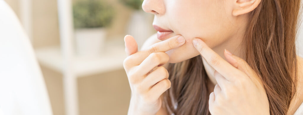 Giovane donna asiatica della pubertà, ragazza che si guarda allo specchio, mostra la spremitura del punto del brufolo per rimuoverlo dal viso. Cura di bellezza dai problemi della pelle mediante il trattamento dell'acne e rosacea